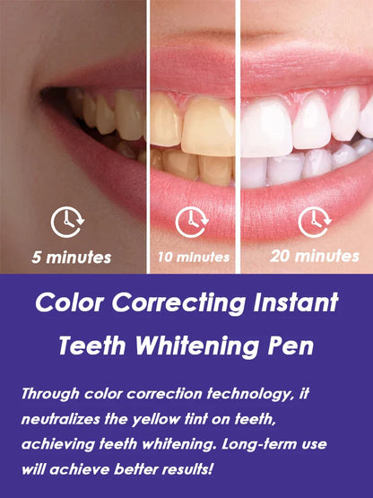 Instant Smile Whitening Pen